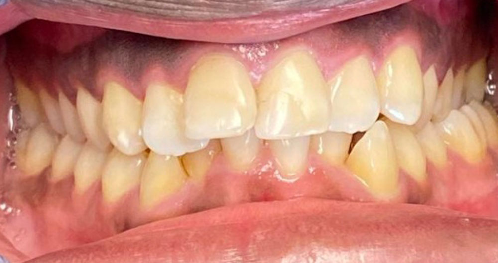 Dental Implant Clinic Houston