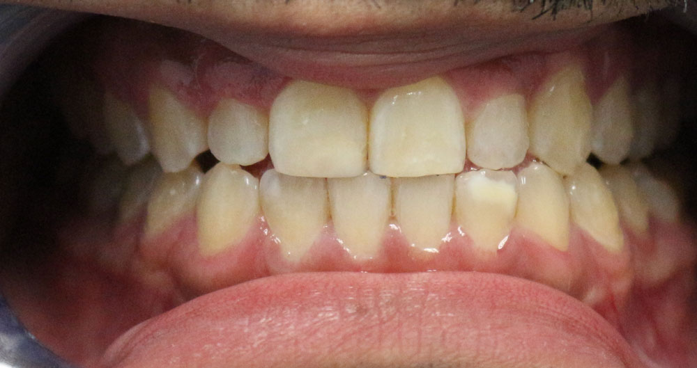 Cosmetic Dentistry Services Houston