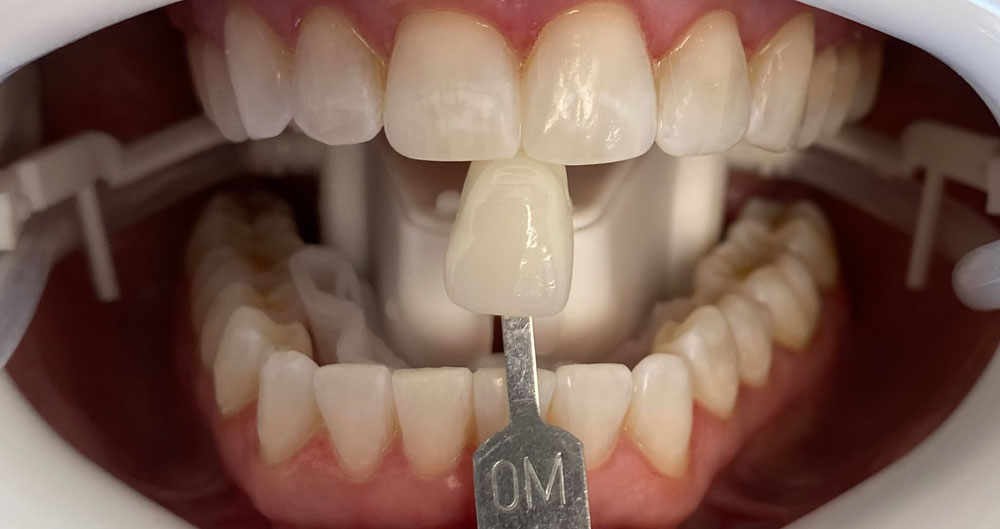 Dentistry Services in Houston, Tx
