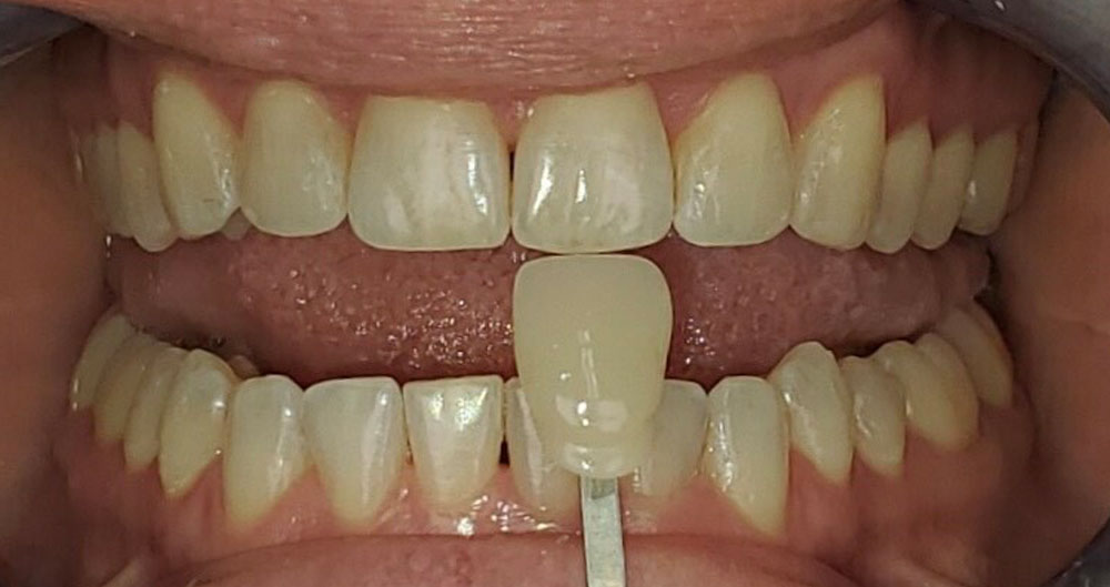 Comprehensive Dental Care in Houston