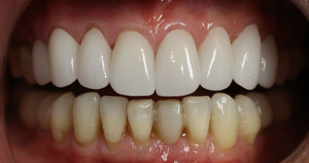 Heights Dentist 77009